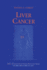 Liver Cancer