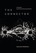 The Connector: Living with Experimental Neuroprosthetics