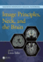 Image Principles, Neck, and the Brain (Magnetic Resonance Imaging Handbook)