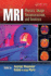 MRI: Physics, Image Reconstruction, and Analysis