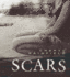 Scars
