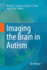 Imaging the Brain in Autism