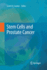 Stem Cells and Prostate Cancer