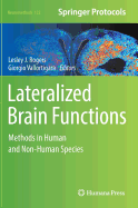 Lateralized Brain Functions