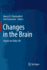 Changes in the Brain: Impact on Daily Life