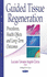 Guided Tissue Regeneration: Procedures, Health Effects and Long-Term Outcomes