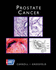Prostate Cancer (American Cancer Society Atlas of Clinical Oncology)