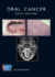 Oral Cancer (American Cancer Society Atlas of Clinical Oncology)