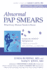 Abnormal Pap Smears: What Every Woman Needs to Know