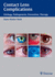 Contact Lens Complications: Etiology, Pathogenesis, Prevention, Therapy