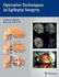 Operative Techniques in Epilepsy Surgery