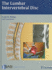 The Lumbar Intervertebral Disc
