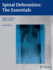Spinal Deformities: the Essentials