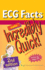 Ecg Facts Made Incredibly Quick!