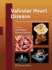 Valvular Heart Disease (Contemporary Cardiology)