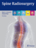 Spine Radiosurgery
