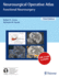 Neurosurgical Operative Atlas: Functional Neurosurgery: 3/E