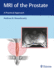 Mri of the Prostate