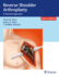 Reverse Shoulder Arthroplasty: a Practical Approach