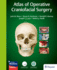 Atlas of Operative Craniofacial Surgery 1st Ed