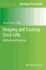 Imaging and Tracking Stem Cells: Methods and Protocols