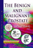 The Benign and Malignant Prostate (Renal and Urologic Disorders)