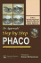 Step by Step Phacoemulsification
