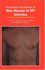 Illustrated Handbook of Skin Disease in Hiv Infection