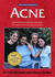 Acne: the 'at Your Fingertips' Guide