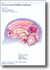 Cavernous Malformations (Aan)