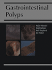 Gastrointestinal Polyps