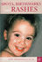 Spots, Birthmarks and Rashes: the Complete Guide to Caring for Your Child's Skin