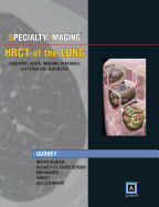 Specialty Imaging: Hrct of the Lung, Anatomic Basis, Imaging Features, Differential Diagnosis