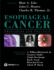 Esophageal Cancer Principles and Practice (Hb 2009)