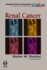 Renal Cancer: Ect (Emerging Cancer Therapeutics, Volume 2, Issue 1)