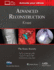 Advanced Reconstruction: Knee: Print + Ebook With Multimedia (Aaos-American Academy of Orthopaedic Surgeons)
