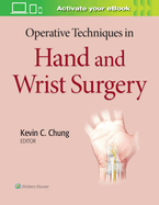 Operative Techniques in Hand and Wrist Surgery With Access Code (Hb 2020)