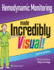 Hemodynamic Monitoring Made Incredibly Visual! (Incredibly Easy! )
