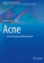 Acne: Current Concepts and Management (Updates in Clinical Dermatology)