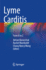 Lyme Carditis: From a to Z