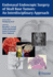 Endonasal Endoscopic Surgery of Skull Base Tumors: an Interdisciplinary Approach