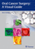 Oral Cancer Surgery: A Visual Guide