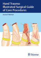 Hand Trauma: Illustrated Surgical Guide of Core Procedures