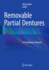 Removable Partial Dentures
