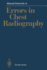 Errors in Chest Radiography