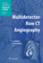 Multidetector-Row Ct Angiography (Diagnostic Imaging)