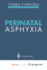 Perinatal Asphyxia