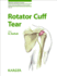 Rotator Cuff Tear