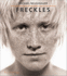 Freckles / By Michael Neugebauer; Foreword By Oliver Walsh