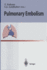 Pulmonary Embolism